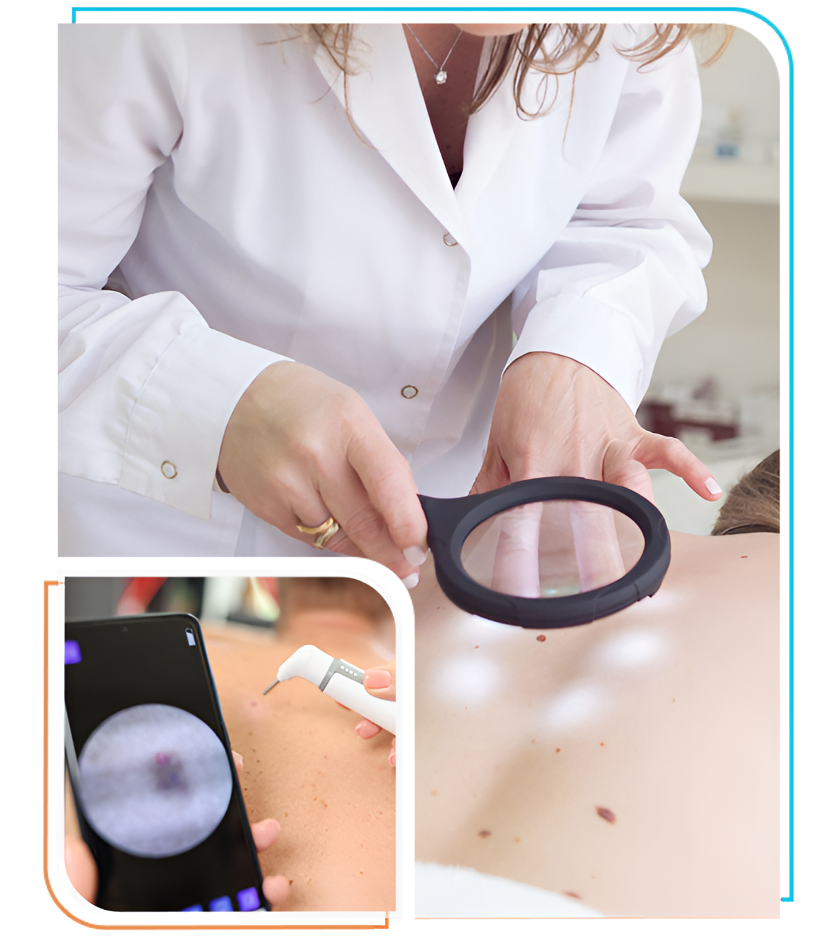 skin cancer check